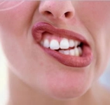 Çene Kayması Belirtileri ve Tedavisi